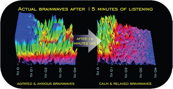 Sample Brainwave Entrainment EEG Readings