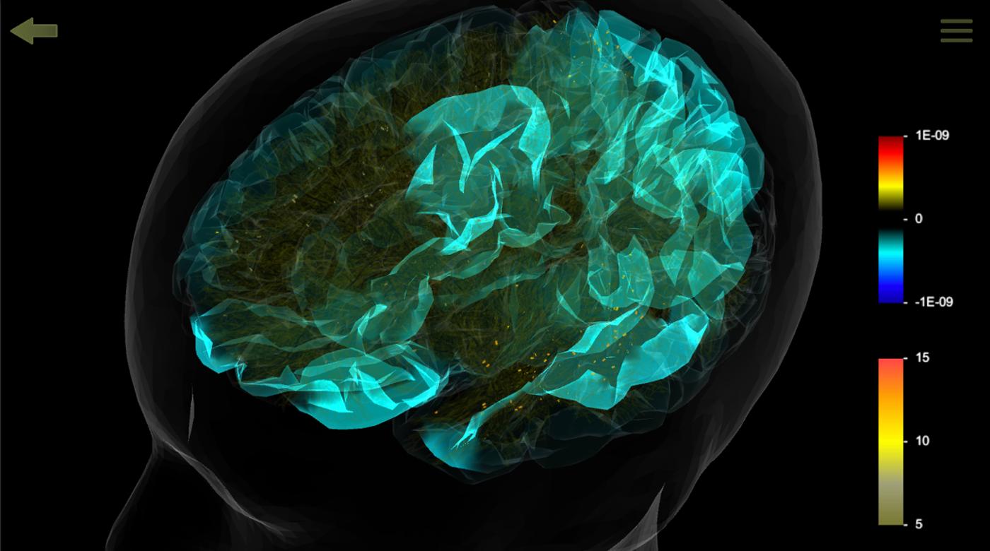 Brain Simulation Section Homepage