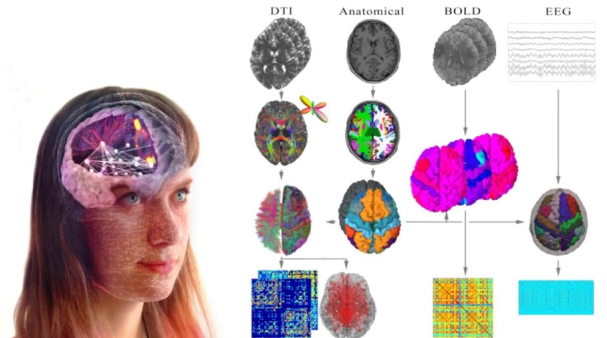 Brain Simulation Section Processing Pipeline for The Virtual Brain now