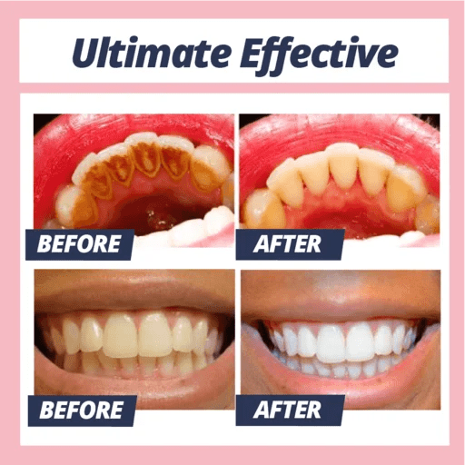 Dr. White Stain Removal Toothpaste Make Your Life Easier