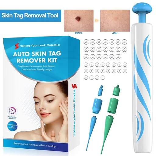 Skin Tag Removal Kit Make Your Life Easier