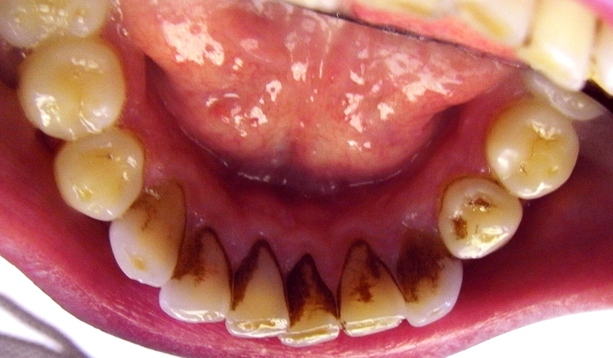 Dental Treatments Broadway Dental Studio Mill Hill