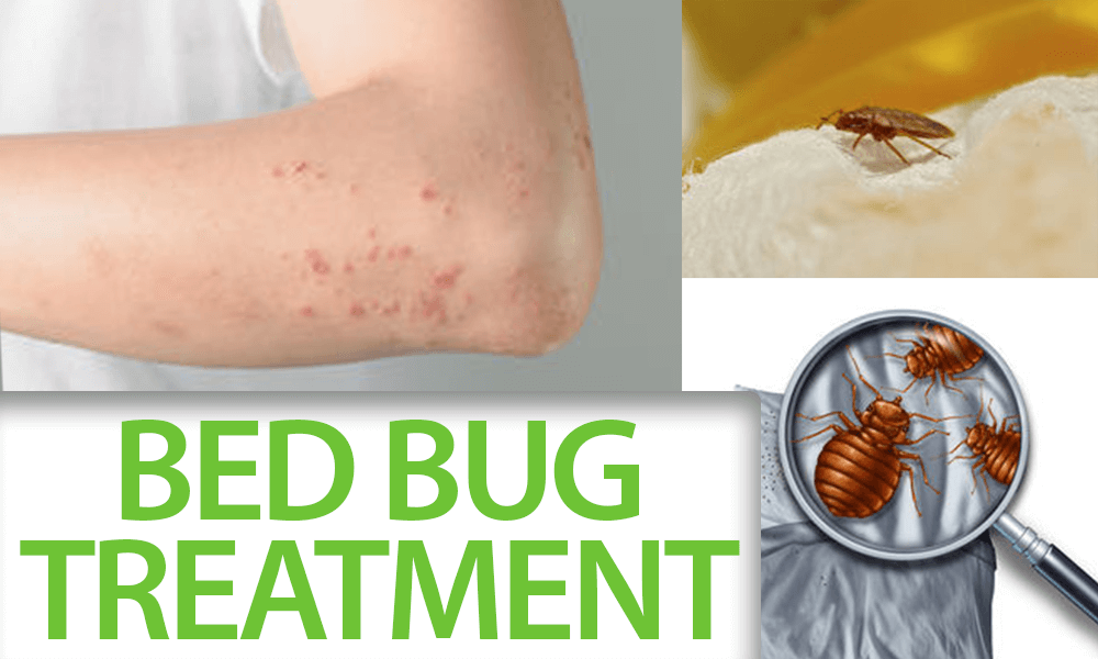 Bed Bug Treatment Brooklyn
