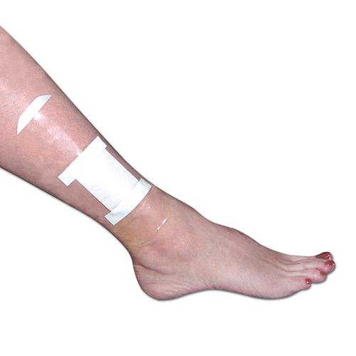 Disposable patches to keep wound sites or surgical dressings dry Brownmed