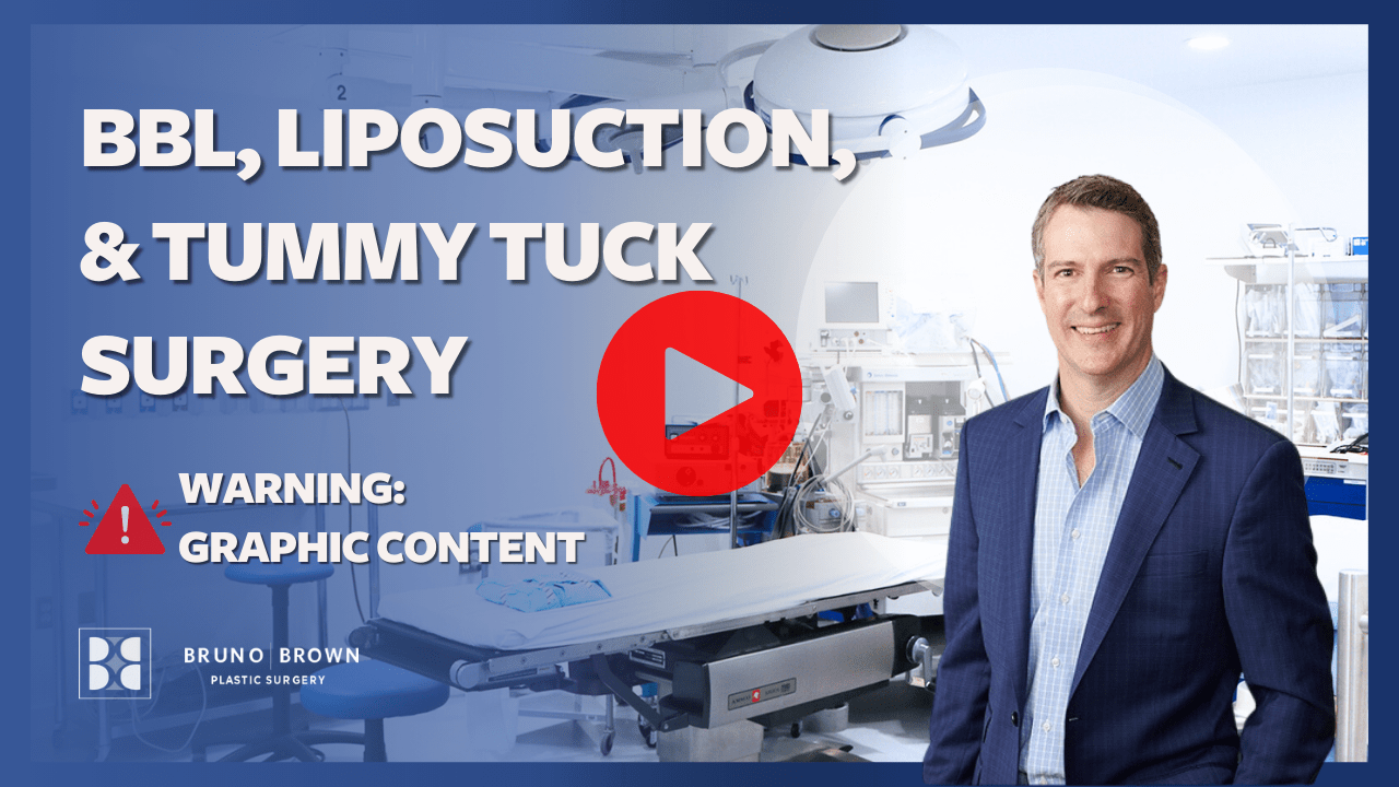 Tummy Tuck Washington, DC, Northern Virginia and Maryland Bruno Brown