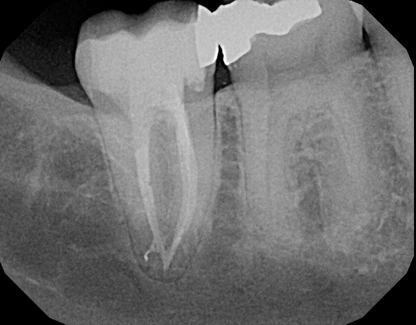 Advanced Technology Wilmington NC, Brunswick Endodontics