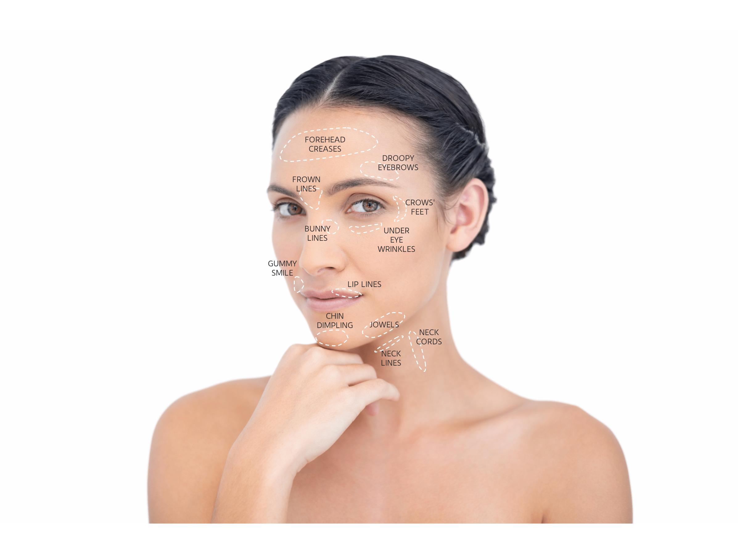 Dermal Fillers in Villanova and Collegeville, PA Bryn Mawr Dermatology