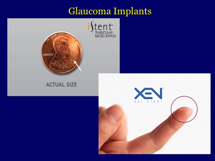 WilkesBarre Hazelton Bucci Vision