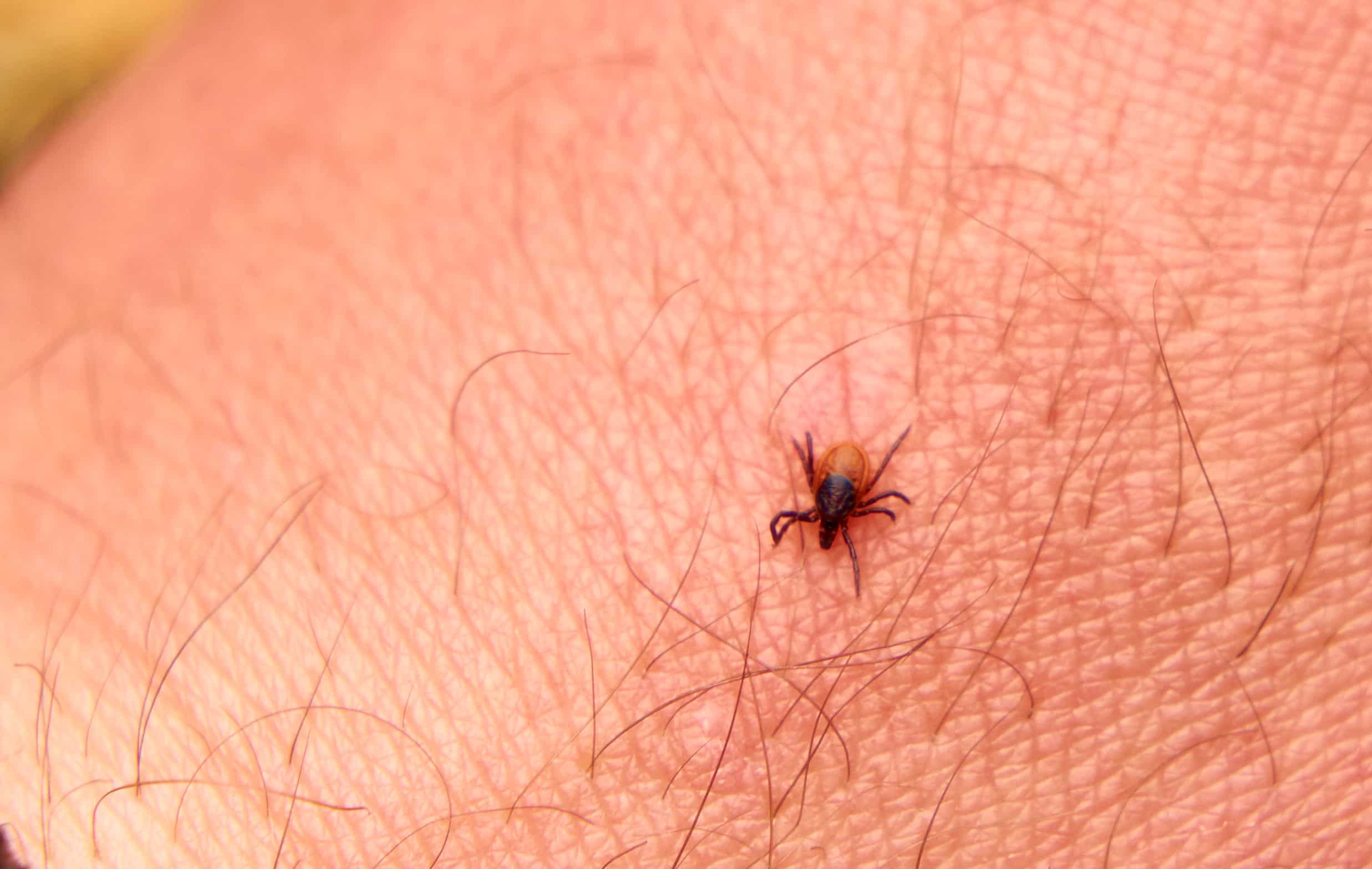 How to Get Rid of Chiggers A Detailed Guide