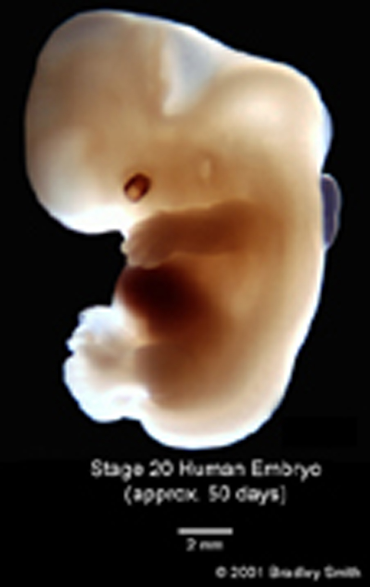 Sciatic nerve jumping jig, raindrop therapy for sciatica 724.3, lower