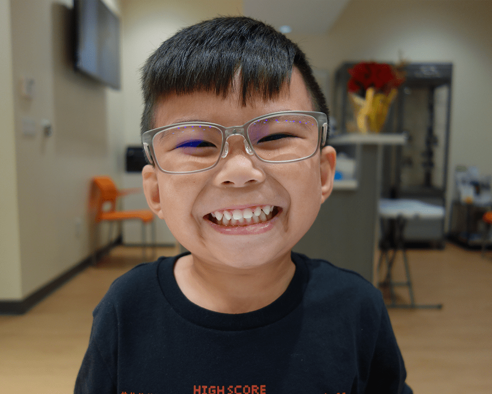 Orthokeratology OrthoK Bright Vision Optometry Chino Hills, CA