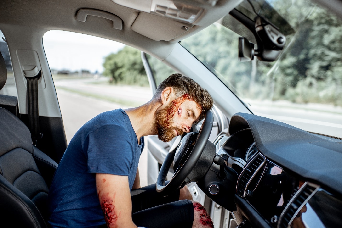 Seeking Compensation for Traumatic Brain Injuries Caused by Car