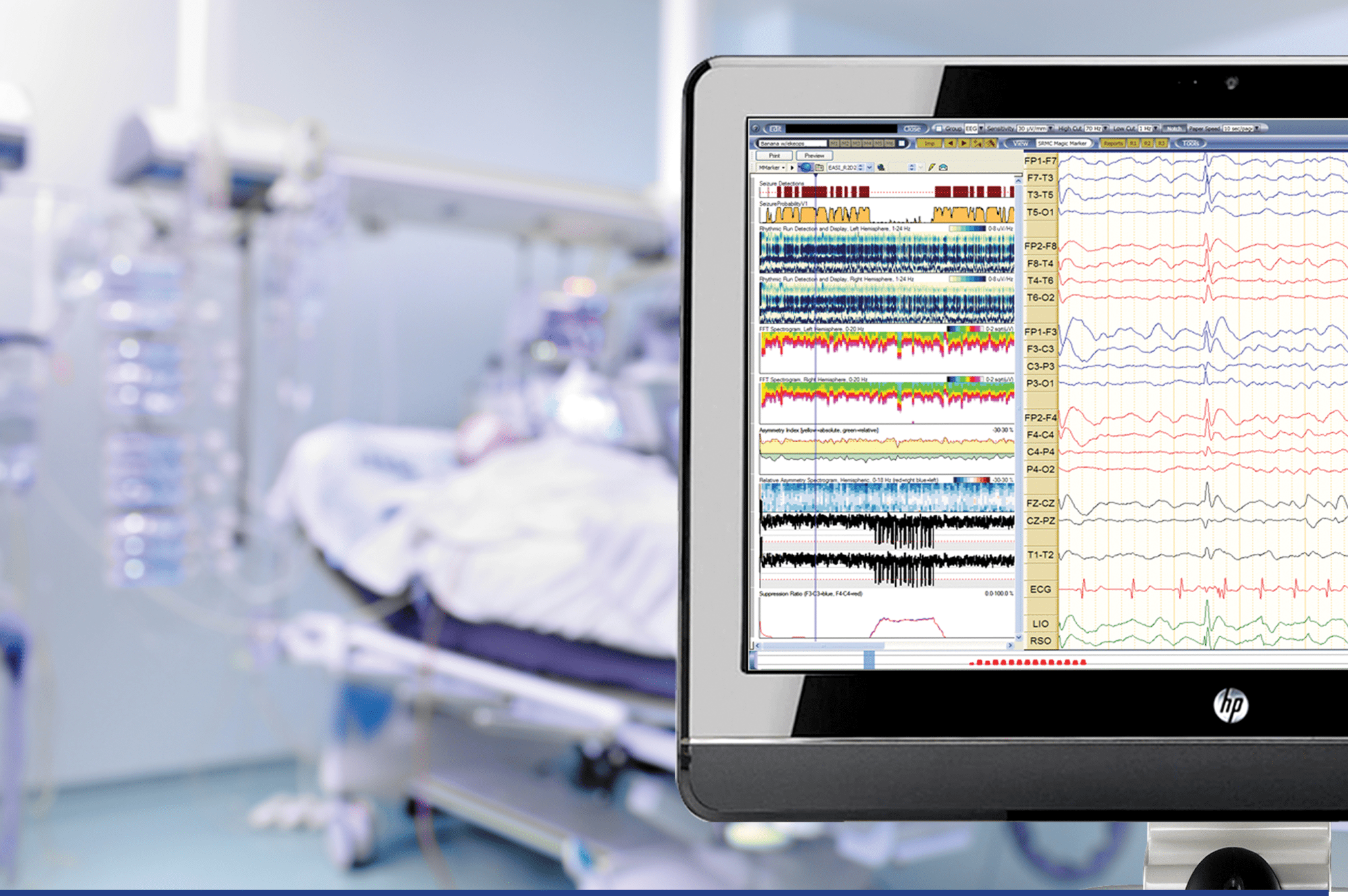 EEG Electroencephalography (EDX) Products EEG Machines