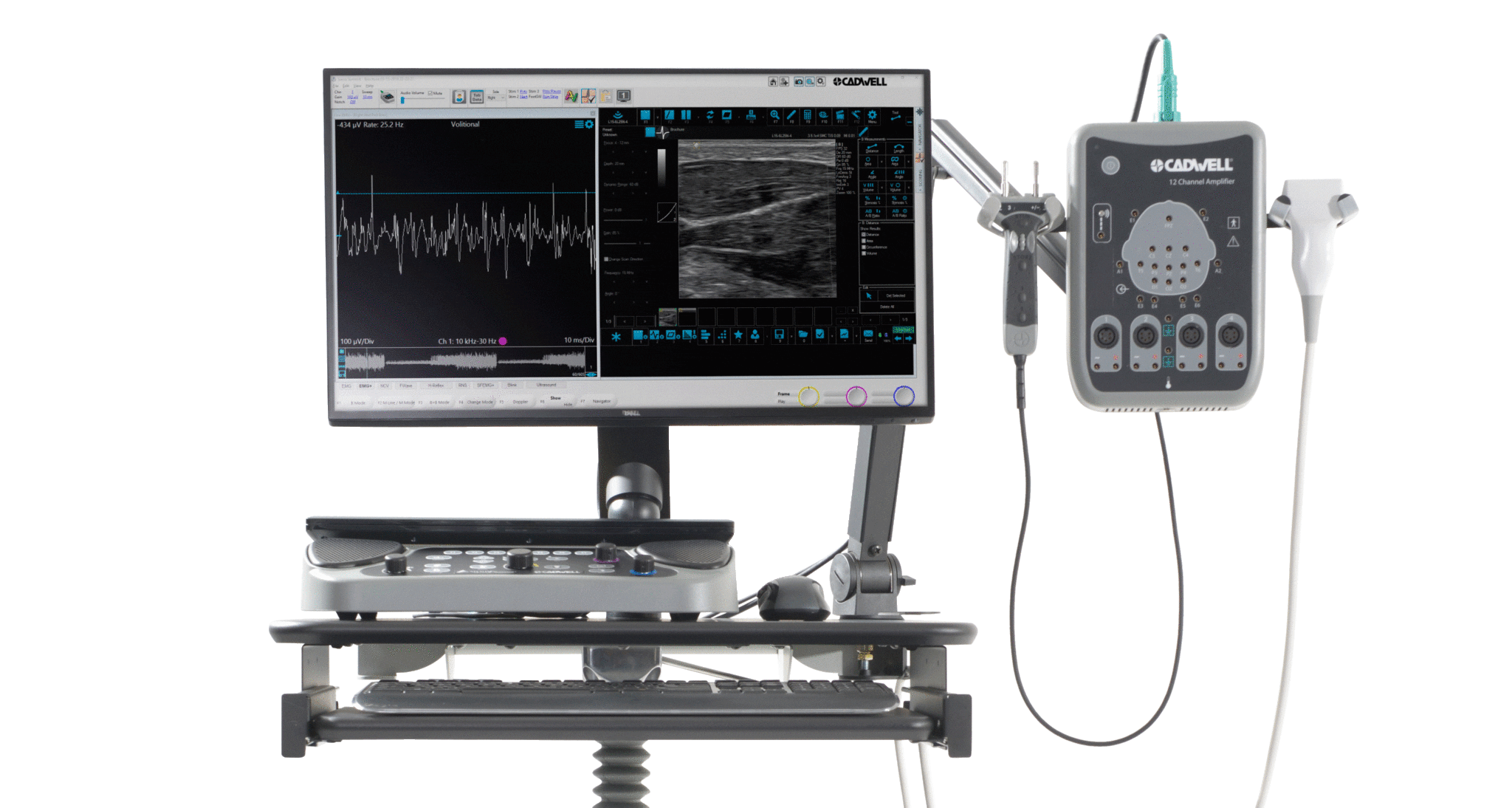 Electromyography (EMG) Summit EMG Machine with EP & Ultrasound