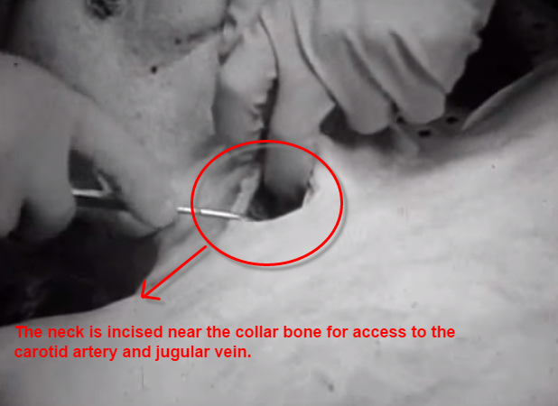 CONFESSIONS OF A FUNERAL DIRECTOR » Eight Photos of the Embalming Process