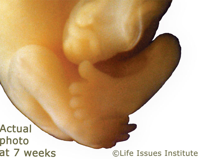 Baby Movements In 7th Month Of Pregnancy Video babypregnancy