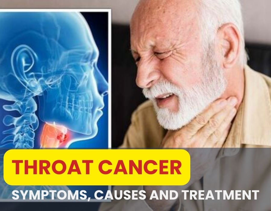 Throat cancer Symptoms, Causes, And Treatment Dr. Ashish Pokharkar