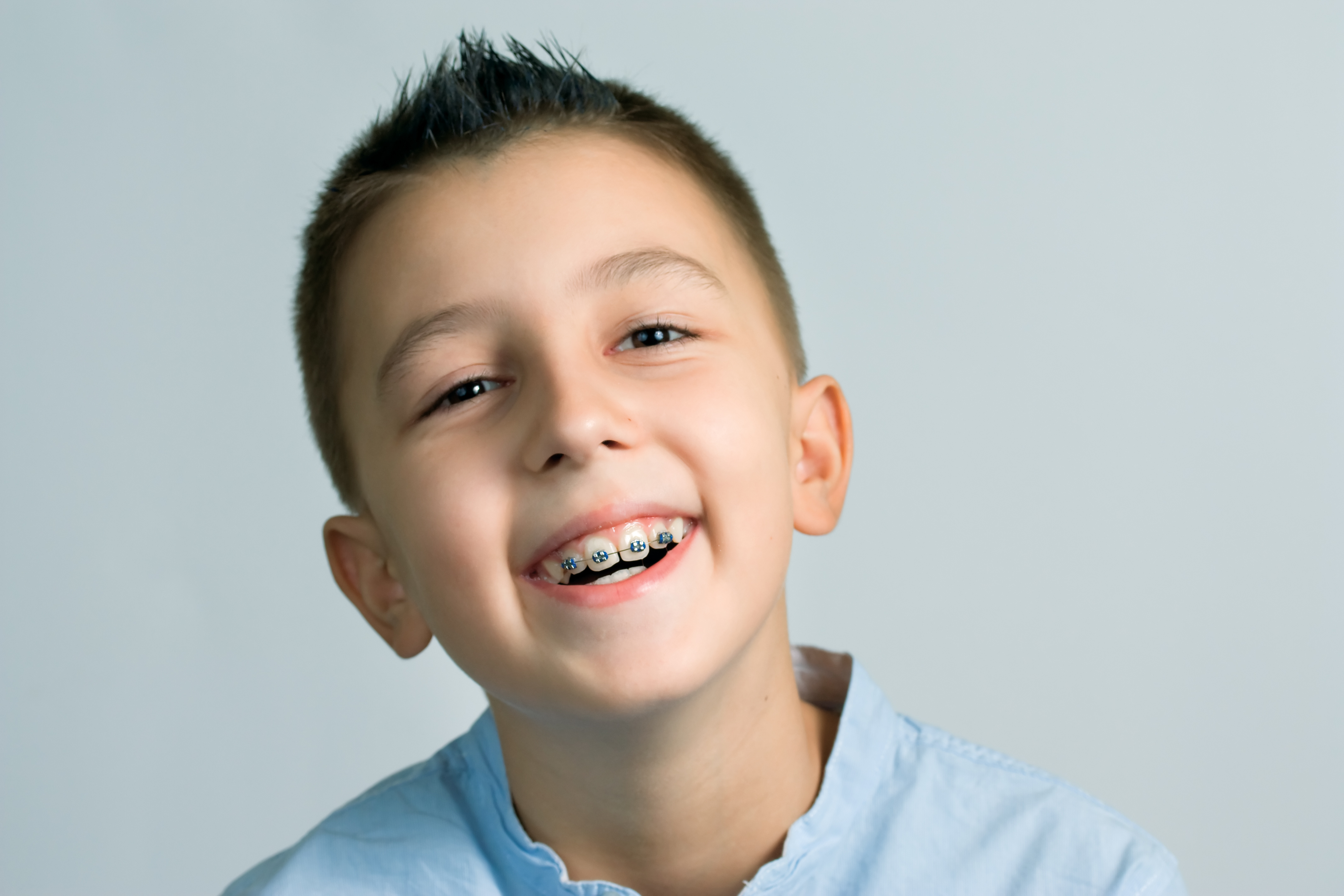 TwoPhase Orthodontic Treatment Oxnard Orthodontics Dr. Jared Lee