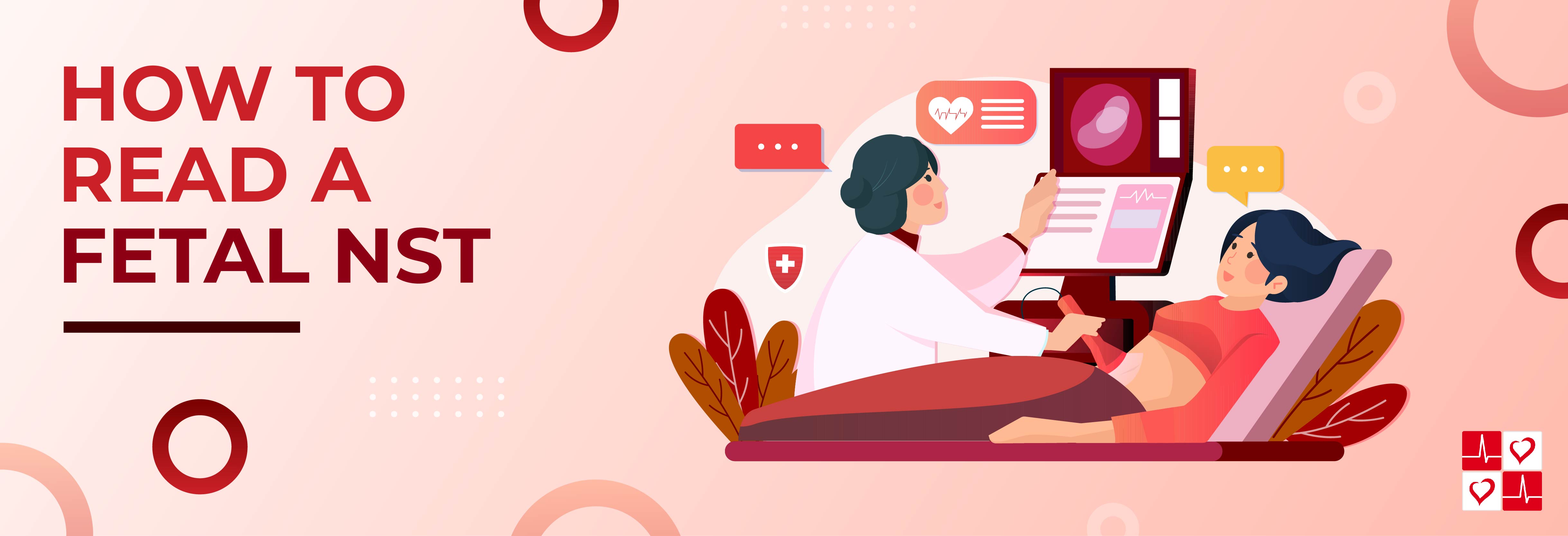 How to Read a Fetal NonStress Test (NST) CardiacDirect