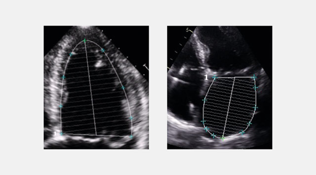 Cardialysis Echocardiography