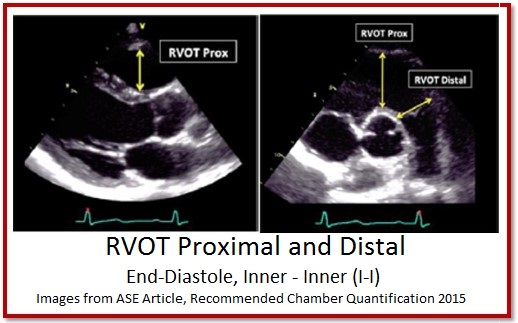 7 Tips to Implementing Right Ventricle Quantification