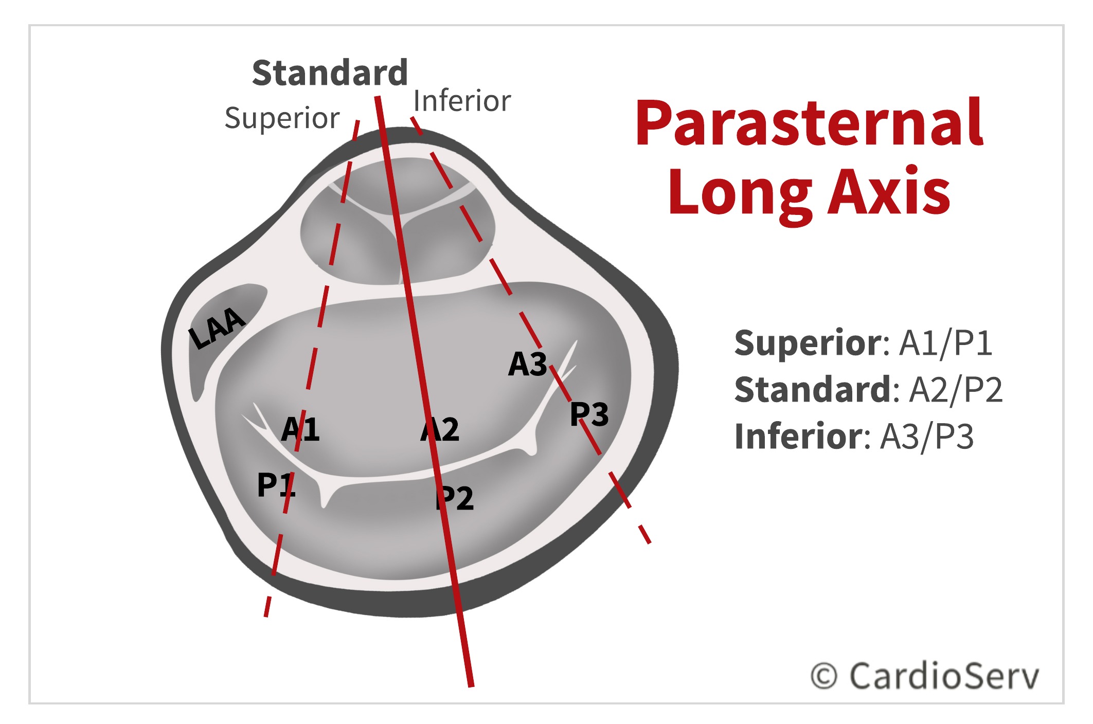 Finally... Mitral Valve Orientation Explained! Cardioserv