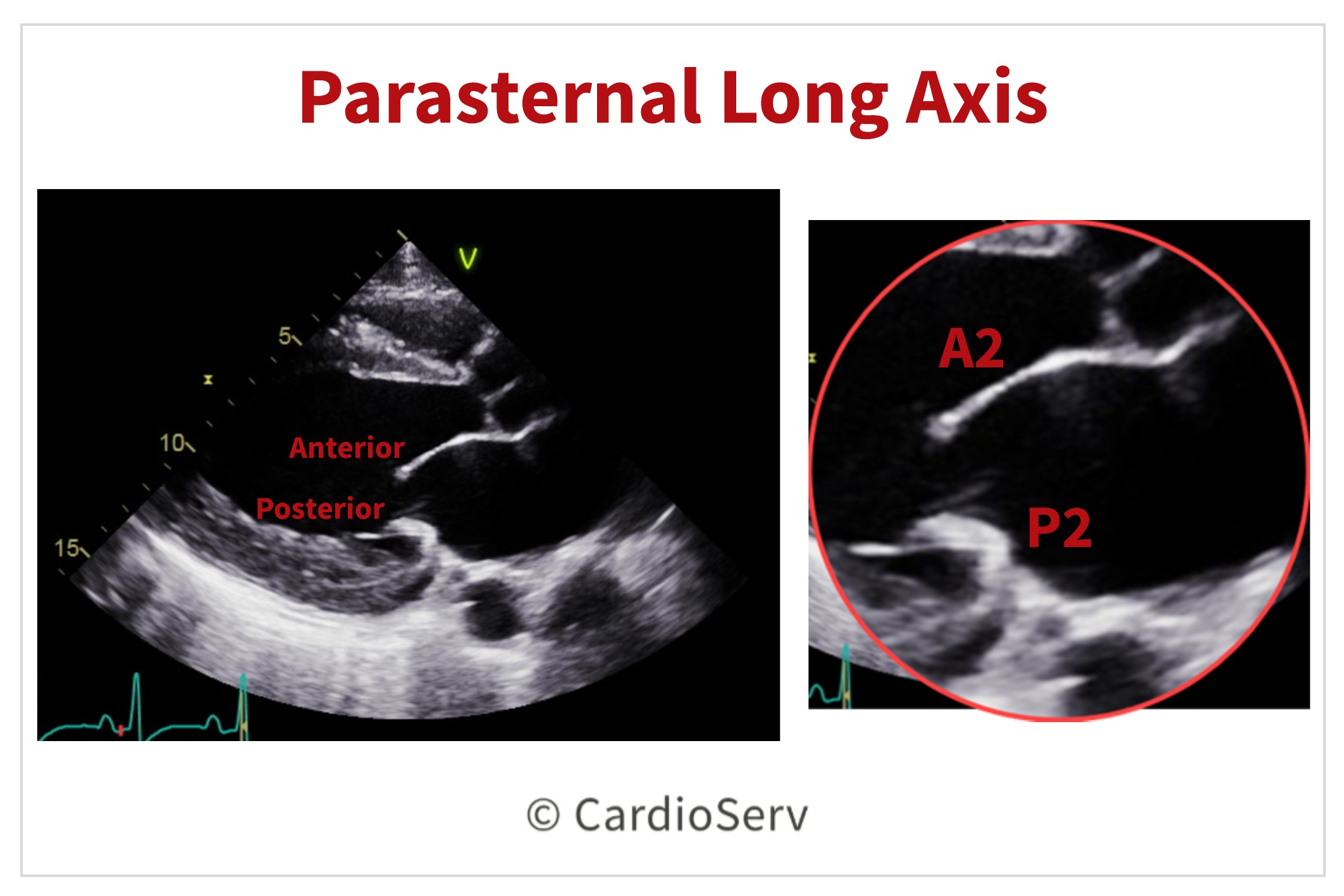 Finally... Mitral Valve Orientation Explained! Cardioserv