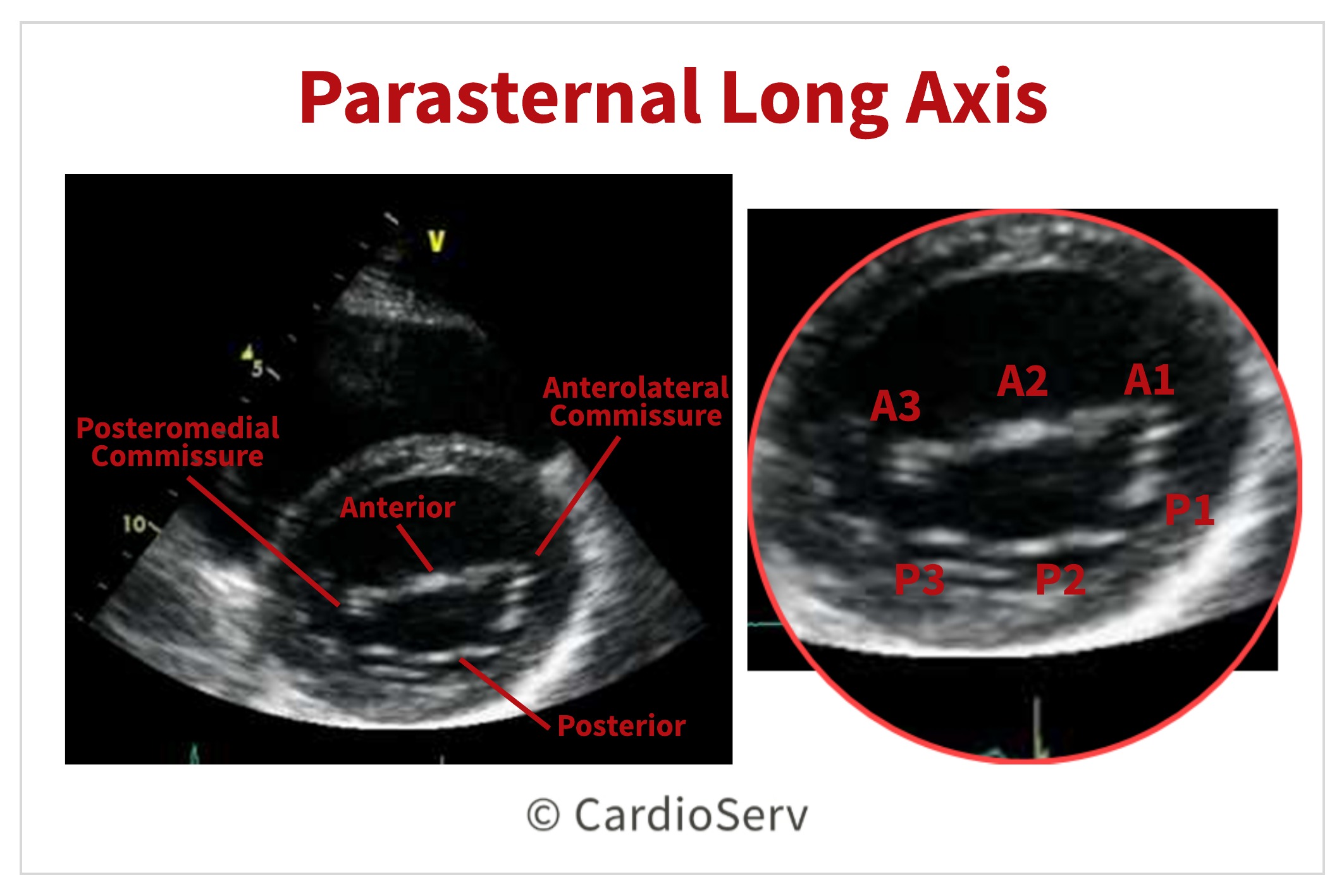 Finally... Mitral Valve Orientation Explained! Cardioserv