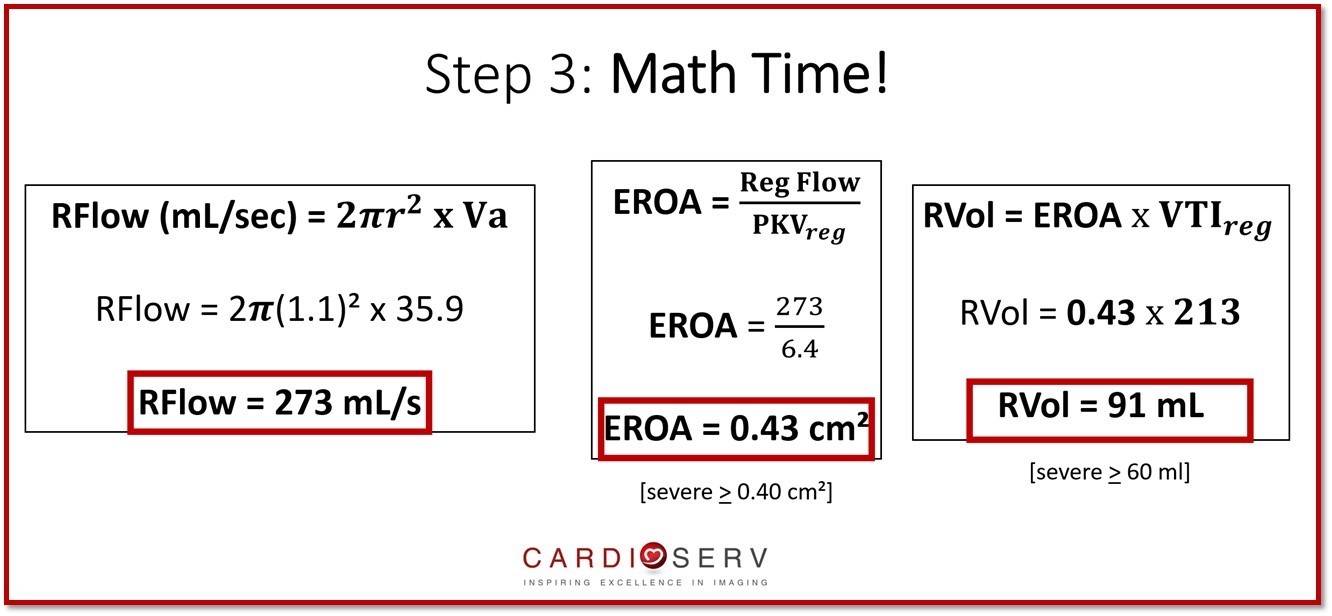 A Complete Guide to Performing MR PISA!
