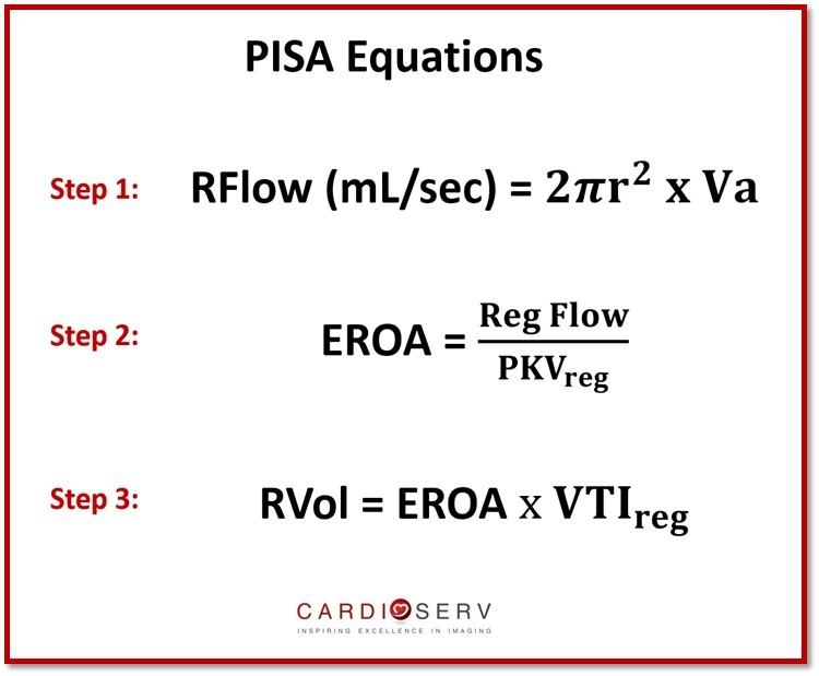 A Complete Guide to Performing MR PISA! Cardioserv