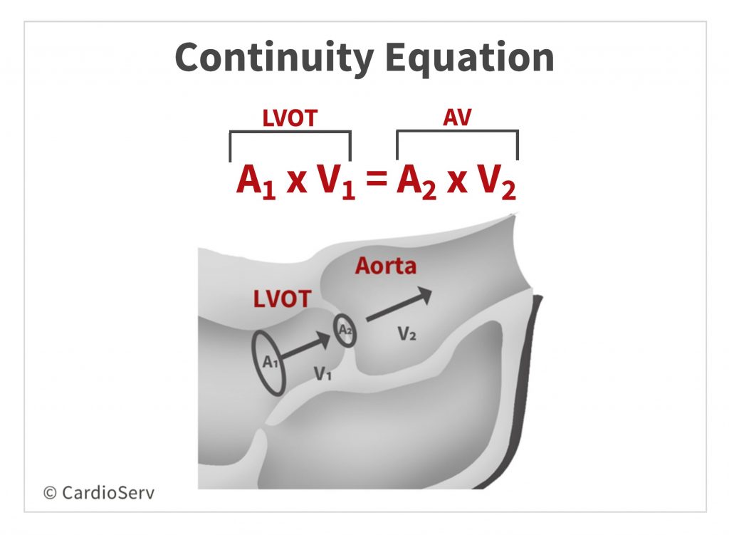Aortic Stenosis Breaking Down the Continuity Equation Cardioserv