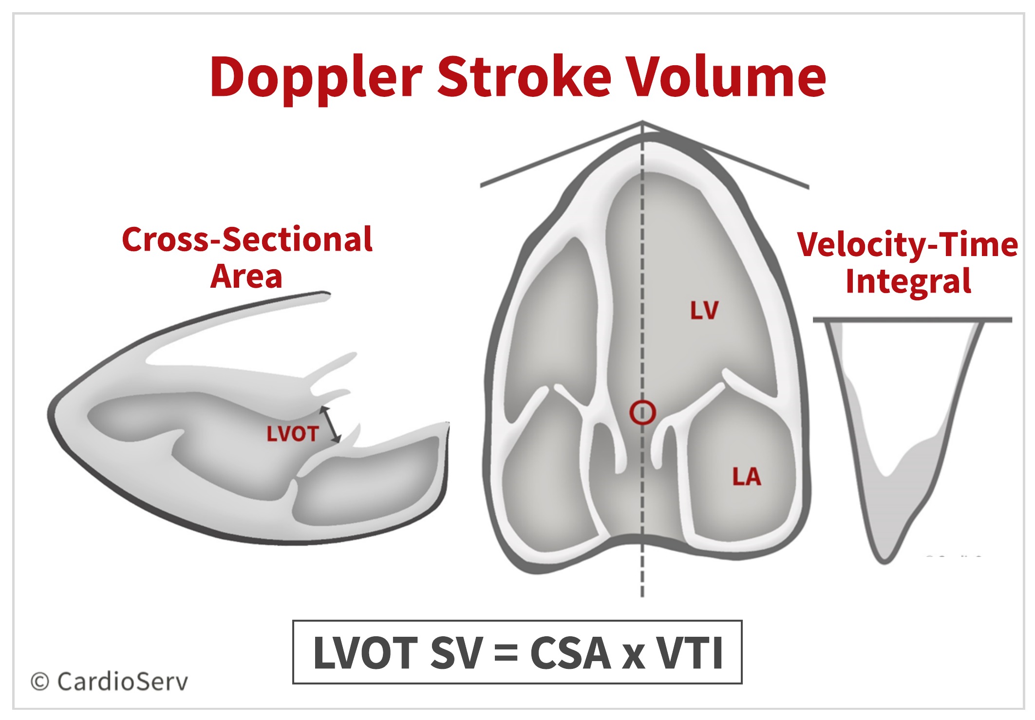 Aortic Stenosis Breaking Down the Continuity Equation