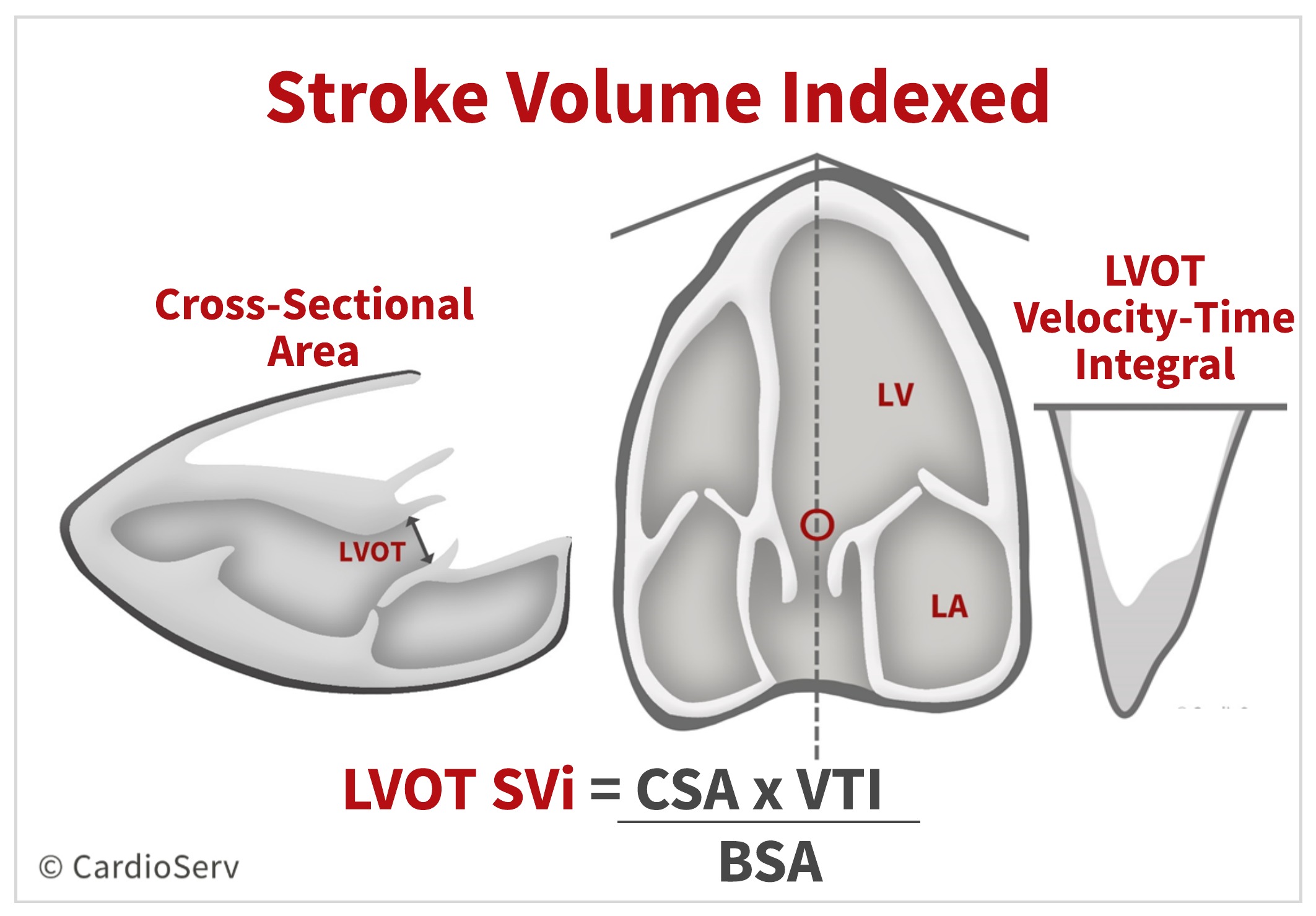 Top 5 Factors to Consider when Evaluating for AS Cardioserv