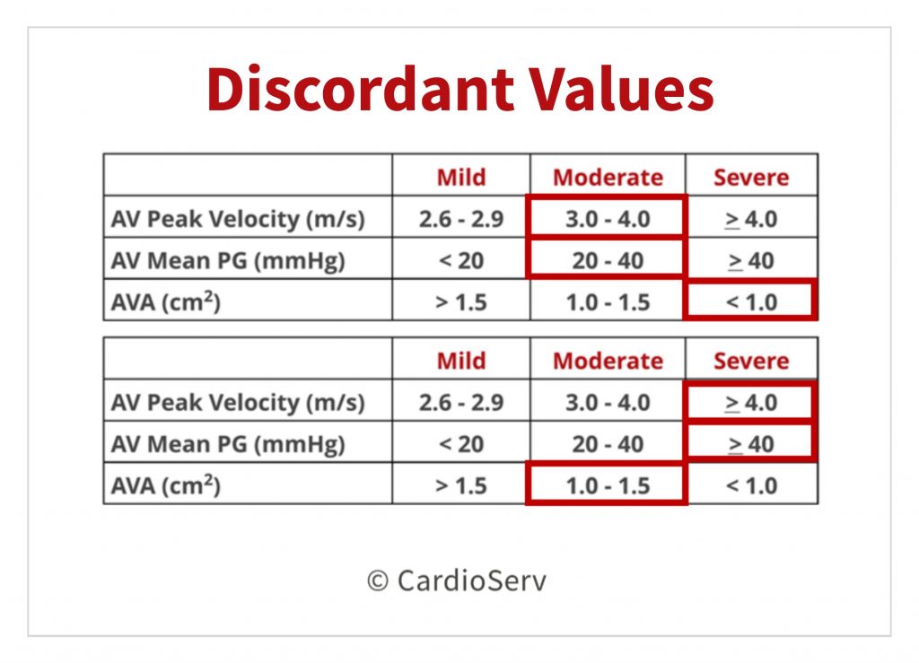 Aortic Stenosis Low Flow, Low Gradient What's the hype?! Cardioserv