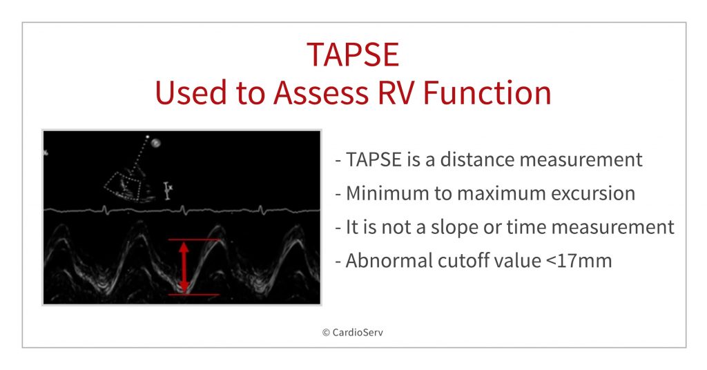 TAPSE as a Prognostic Tool in Pulmonary Embolism Cardioserv