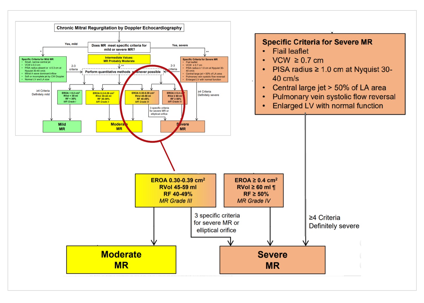 Grading MR Severity with Echo echo MR grading severity Cardioserv