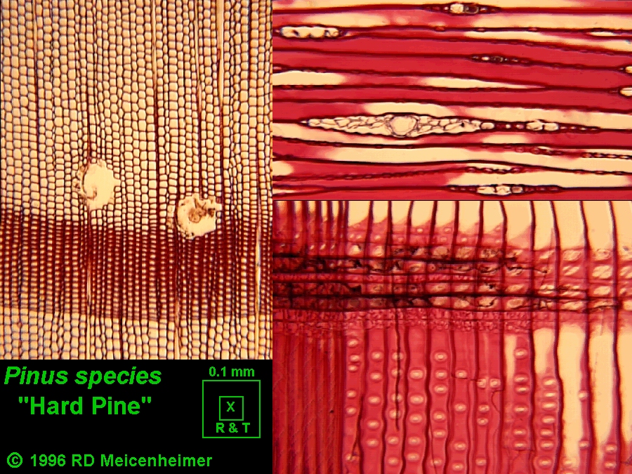 Gymnosperm Wood without Axial Parenchyma