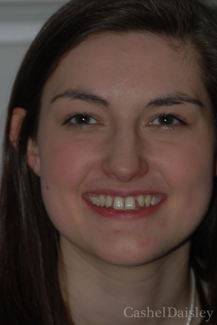 Ortho Cosmetic dentistry Glasgow Cashel Daisley for the perfect smile