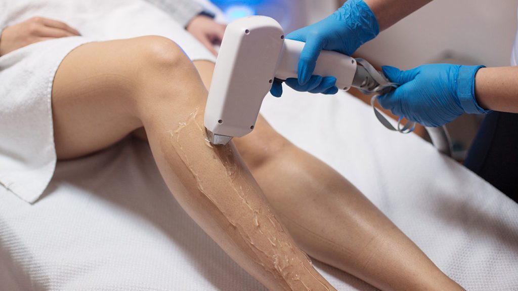 Electrolysis Vs Laser The Hair Removal Debate Catsup and Mustard