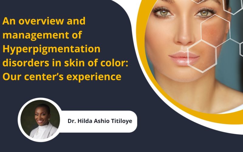 Dr. Hilda Titiloye An overview and management of hyperpigmentation