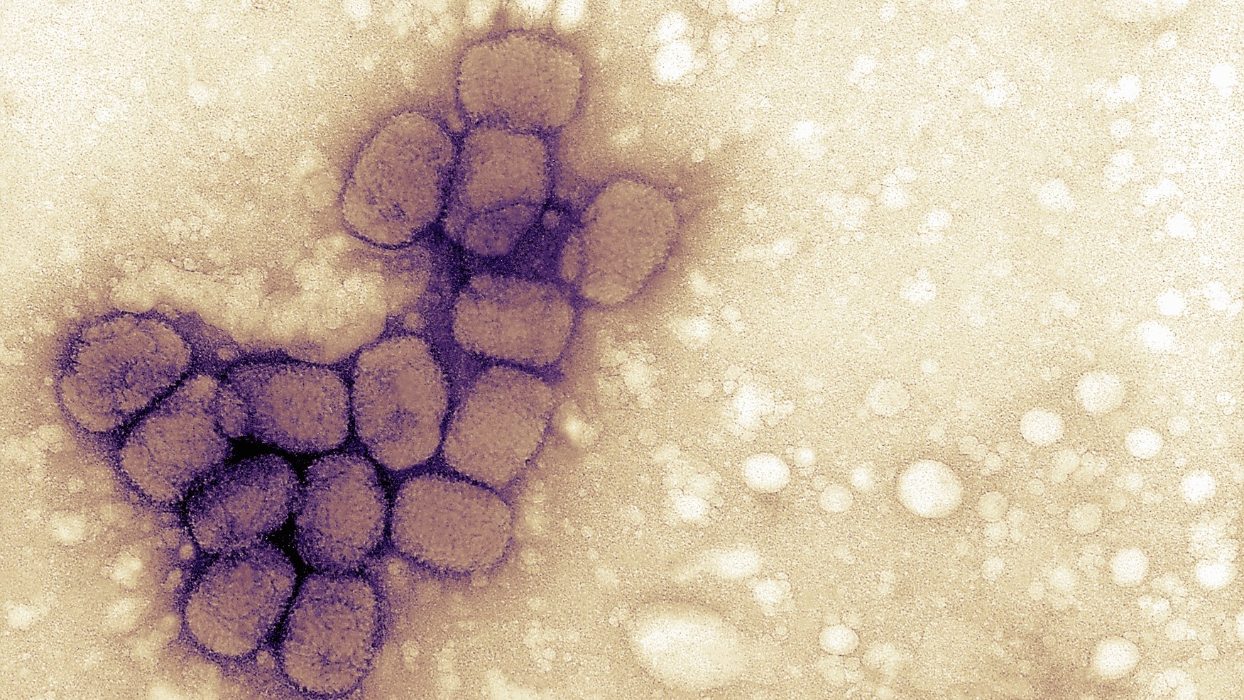 Lab worker finds vials labeled 'smallpox' at Merck facility