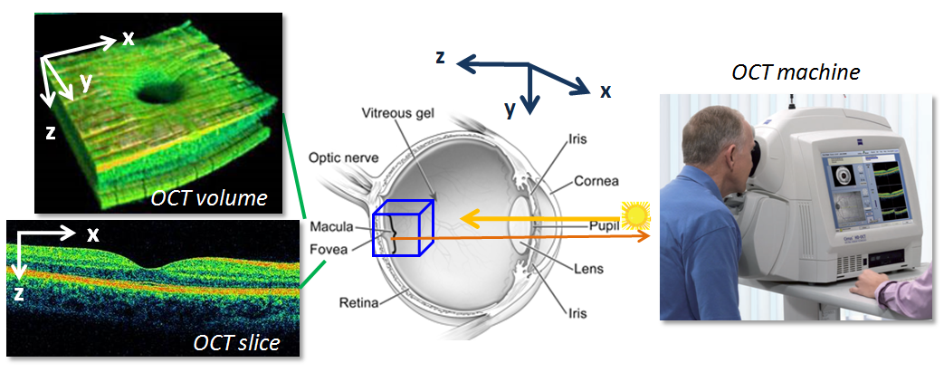 Automated Macular Pathology Diagnosis in Retinal OCT Images