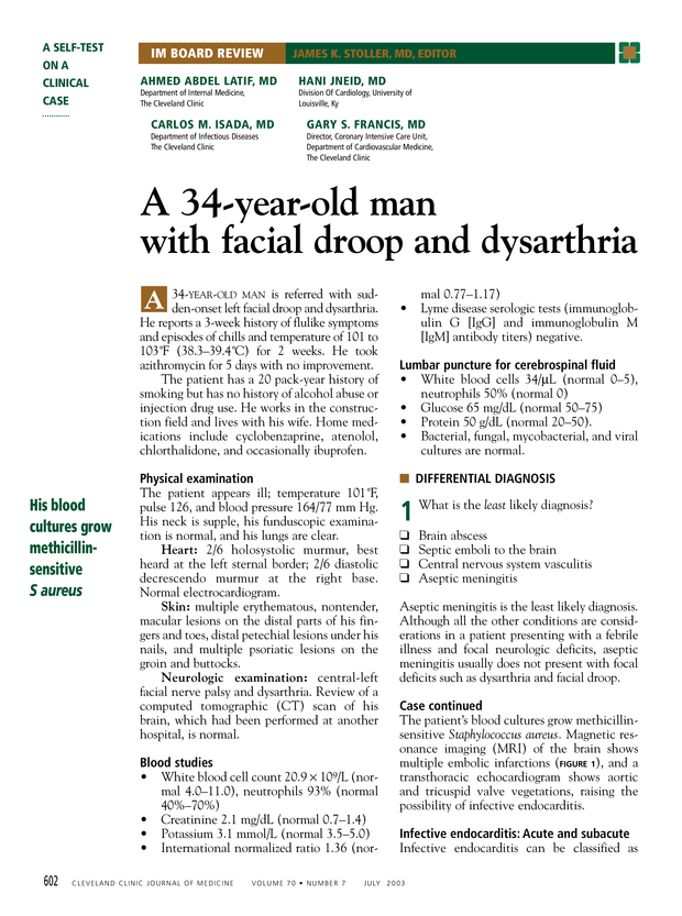 A 34yearold man with facial droop and dysarthria Cleveland Clinic