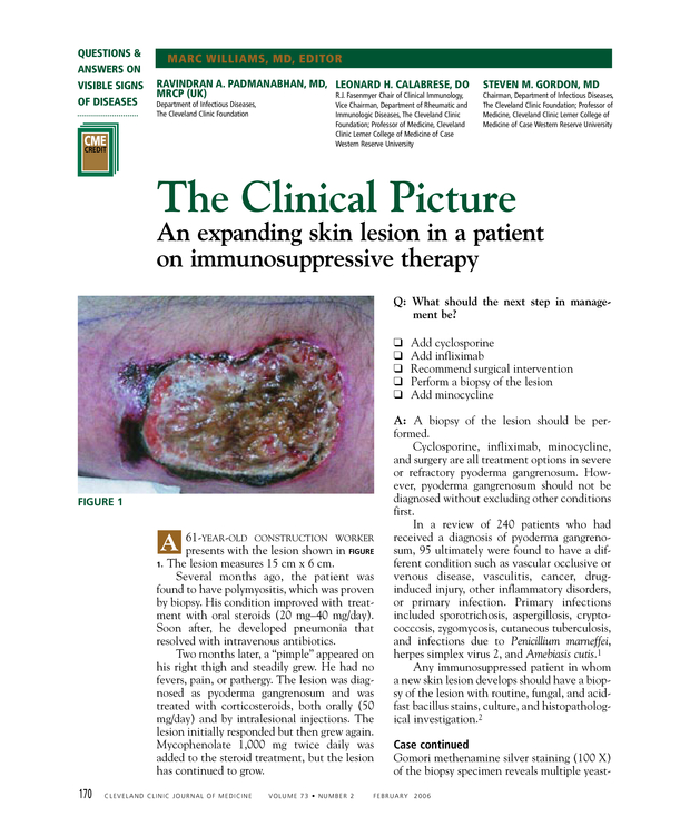 An expanding skin lesion in a patient on immunosuppressive therapy Cleveland Clinic Journal of