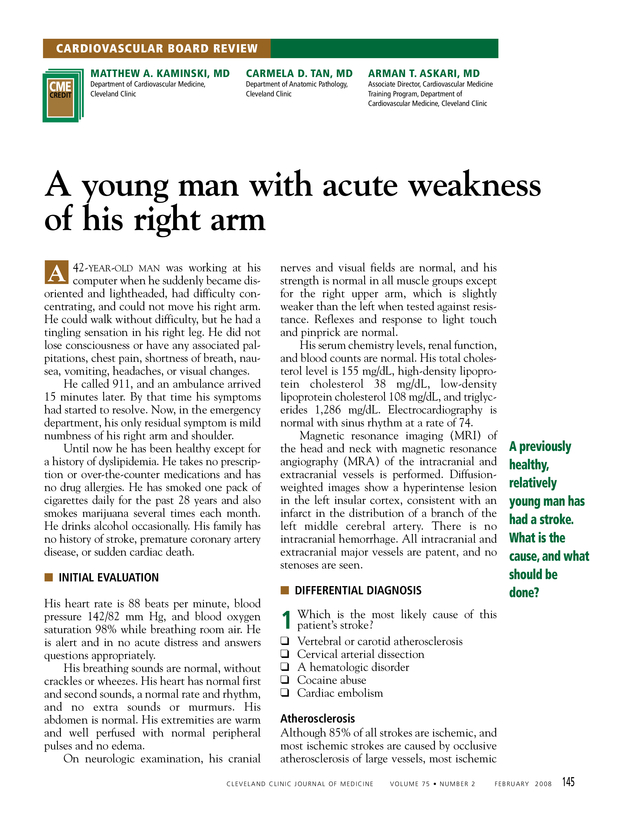 A young man with acute weakness of his right arm Cleveland Clinic