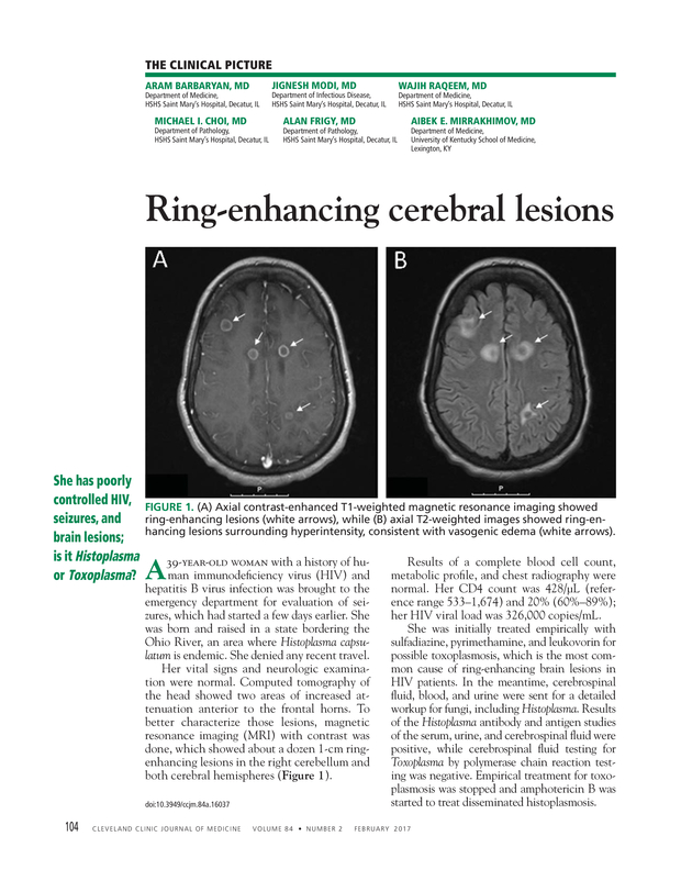 Ringenhancing cerebral lesions Cleveland Clinic Journal of Medicine