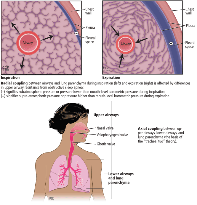 The intersection of obstructive lung disease and sleep apnea
