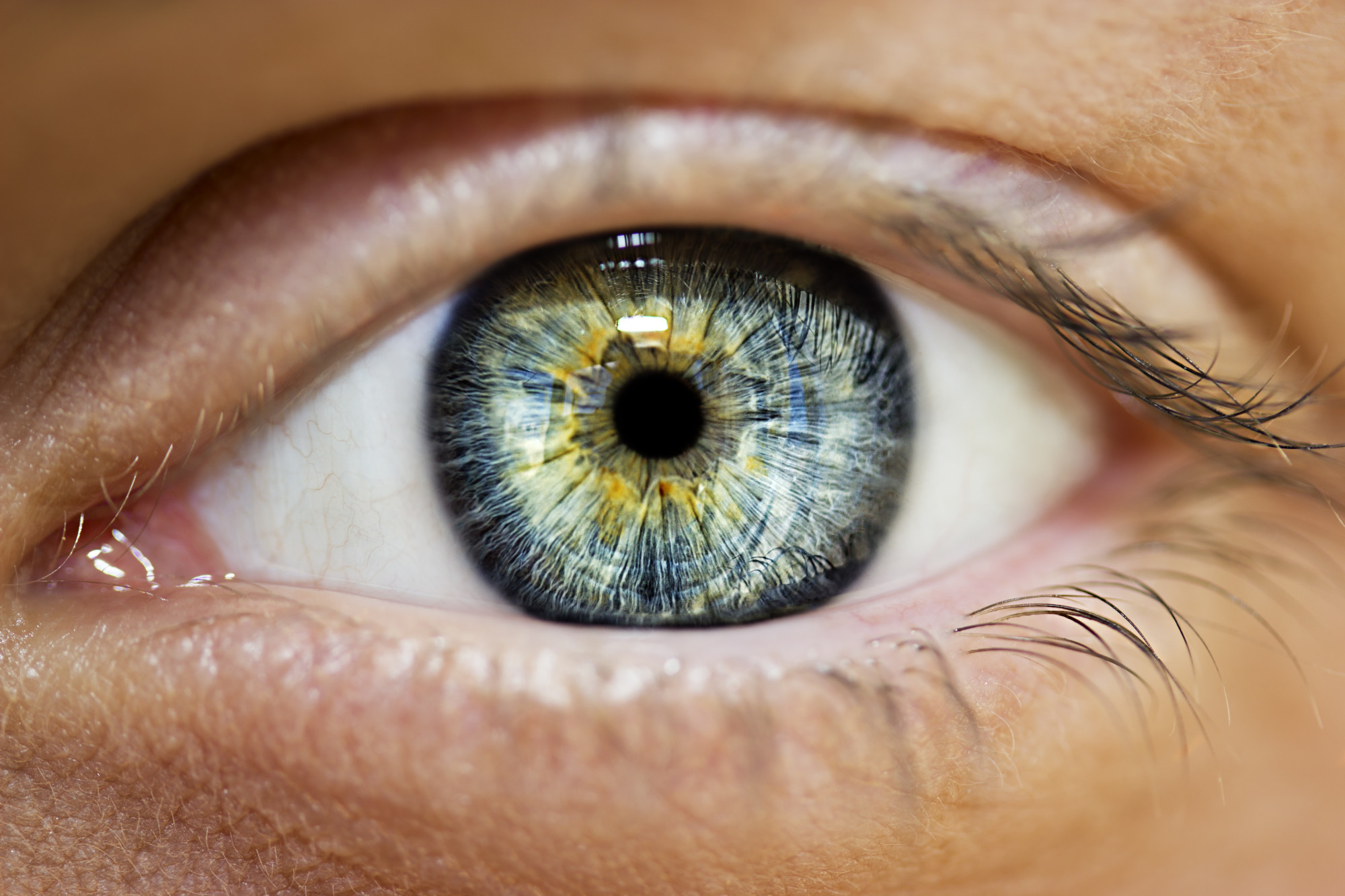 Retina