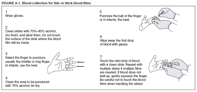 Appendix P P Microscopic Procedures For Diagnosing Malaria