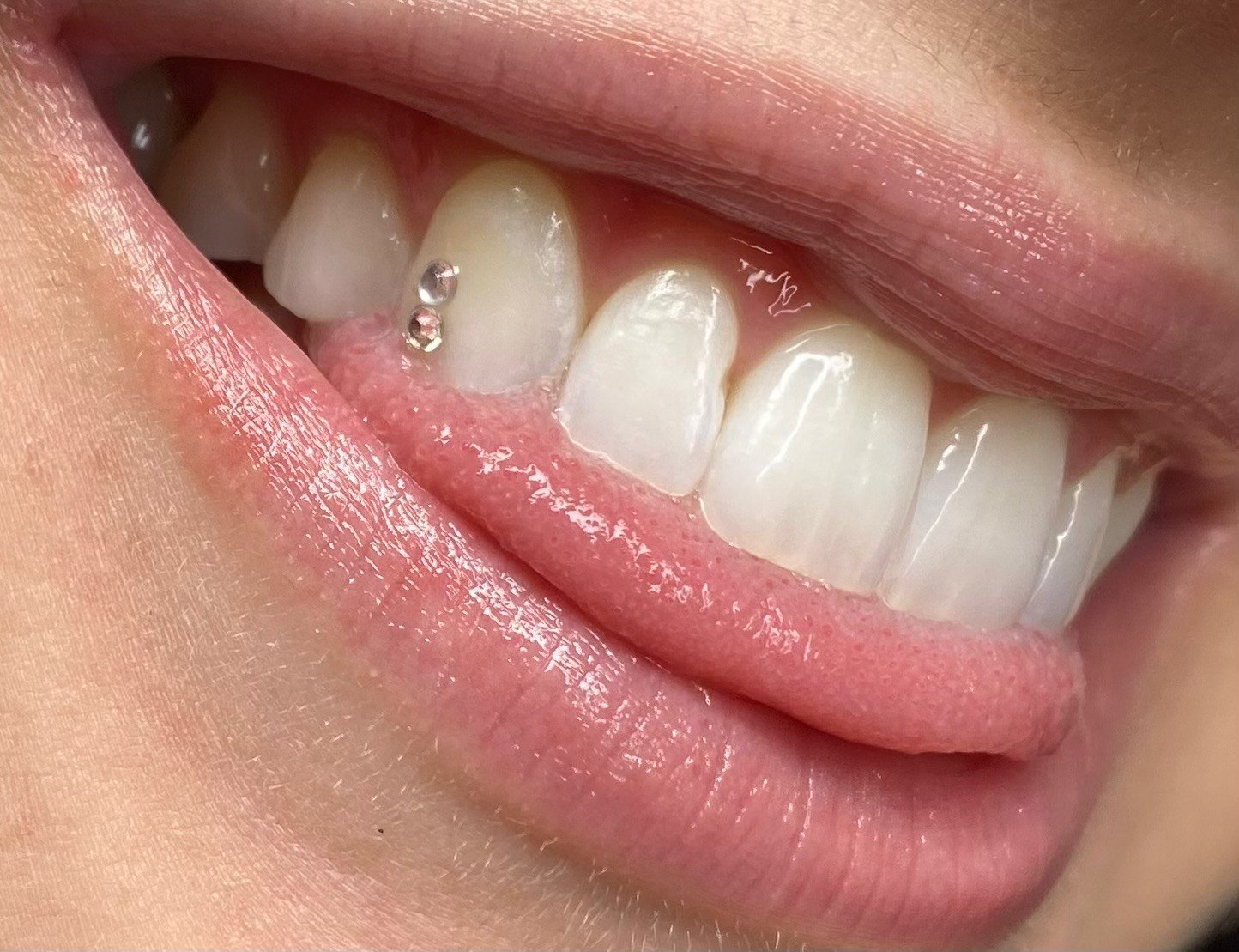 Who can put on tooth gems? (Dos and Don'ts)